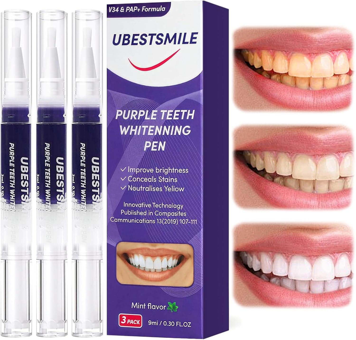 Teeth Whitening Pens - UBESTSMILE V34&PAP+ Formula Mor Diş Beyazlatma