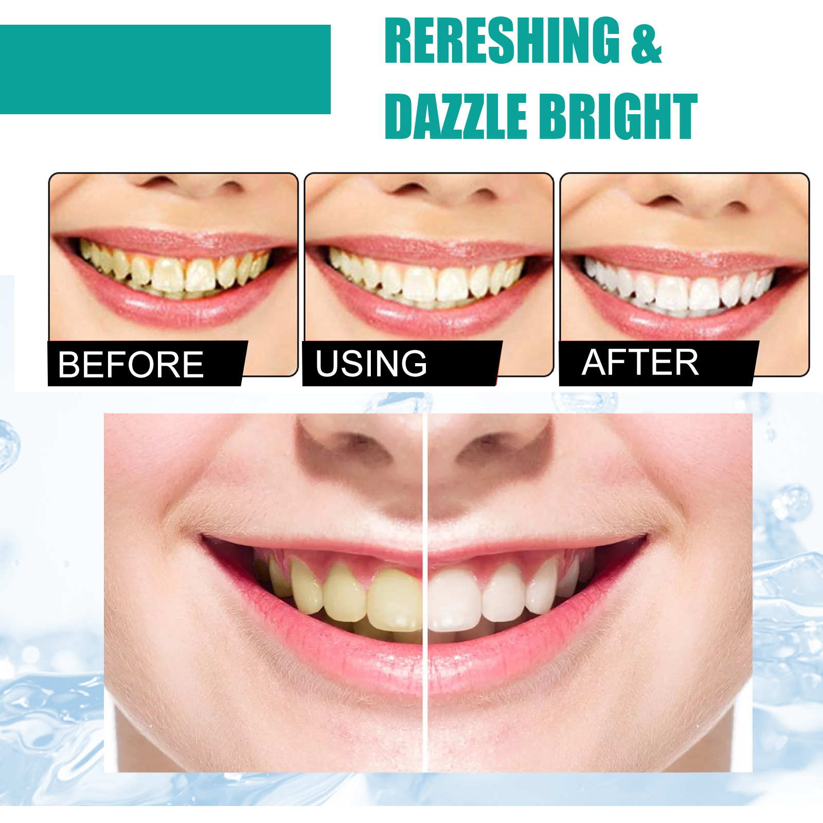 Nane Diş Tozu Taze Nefes 5 Gün - Teeth Whitening Near Me incelemesi ve fiyatı