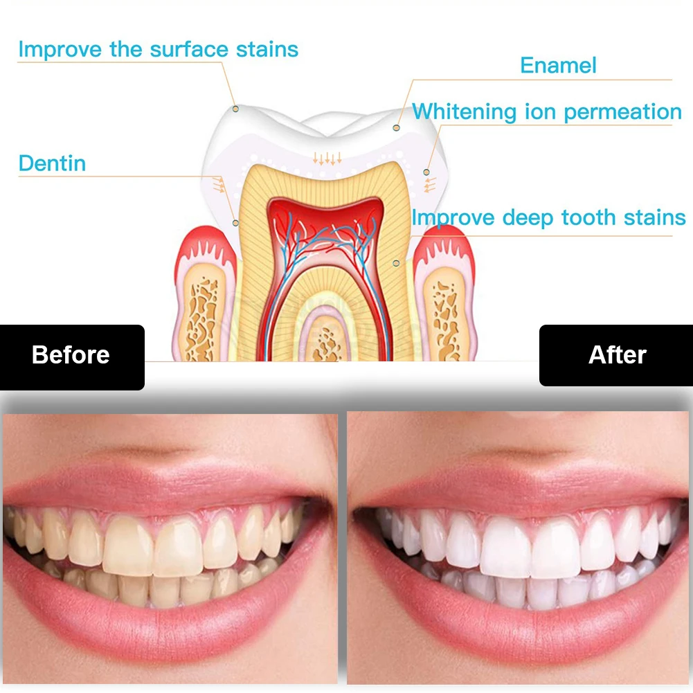Diş Diş Beyazlatma Kiti Mini 1 - Teeth Whitening Near Me incelemesi ve fiyatı